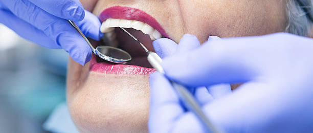 Best Teeth Whitening  in Milton, FL